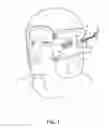 Fig. 02 - Headwear with storable accessory