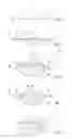 Fig. 03 - Tissue treatment stick