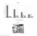 Fig. 03 - Fiber comprising a biodegradable polymer