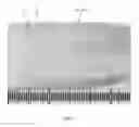 Fig. 02 - Fenestrated bone wrap graft