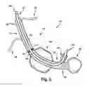 Fig. 06 - Reversible airway device and related method for ventilating a subject