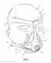 Fig. 02 - Wear-out indicator for a patient interface