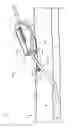 Fig. 02 - System for anchoring medical devices