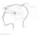 Fig. 01 - EQUIPMENT FOR APPLYING ACTIVE ELEMENTS TO THE SKULL OF A PATIENT