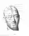 Fig. 03 - EQUIPMENT FOR APPLYING ACTIVE ELEMENTS TO THE SKULL OF A PATIENT