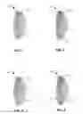 Fig. 02 - METHODS AND DEVICES FOR STEREOTACTIC RADIOSURGERY