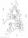 Fig. 02 - Hand clamp improvement and accessory