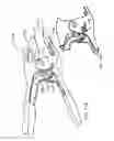 Fig. 12 - Hand clamp improvement and accessory