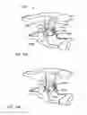 Fig. 13 - Hand clamp improvement and accessory