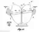 Fig. 12 - Rotatable manifold cutter for use in portioning