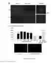 Fig. 03 - Human soluble CD146, preparation and uses thereof