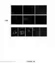 Fig. 04 - Human soluble CD146, preparation and uses thereof