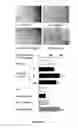 Fig. 05 - Human soluble CD146, preparation and uses thereof