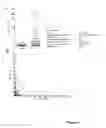 Fig. 06 - Method for treating and diagnosing disease using inhibitors of goodpasture antigen binding protein
