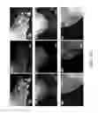 Fig. 22 - CELL CULTURE DEVICE, METHOD OF FORMING THE SAME, AND METHOD OF PARTIALLY DETACHING STEM CELLS FROM THE SAME