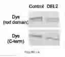 Fig. 02 - Methods and materials for activating an internal ribosome entry site in exon 5 of the DMD gene
