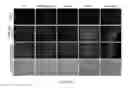Fig. 50 - Methods and materials for activating an internal ribosome entry site in exon 5 of the DMD gene