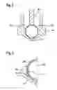 Fig. 03 - Valve and method for producing a valve
