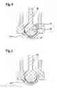 Fig. 04 - Valve and method for producing a valve