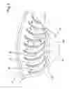 Fig. 05 - SIDE-CHANNEL BLOWER / ASPIRATOR WITH AN IMPROVED IMPELLER