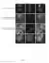 Fig. 07 - A PROTEIN TAGGING SYSTEM FOR IN VIVO SINGLE MOLECULE IMAGING AND CONTROL OF GENE TRANSCRIPTION