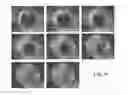Fig. 22 - Eluting analytes from bead arrays