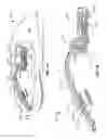 Fig. 04 - Keyplate system for an input device