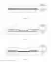 Fig. 04 - Touch substrate, touch display panel and display device