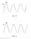 Fig. 04 - Touch sensing circuit and a signal demodulating method