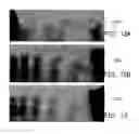 Fig. 08 - Medical image processing apparatus and breast image processing method thereof