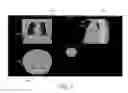 Fig. 04 - Overlay Of Findings On Image Data