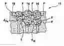 Fig. 01 - Separator comprising force-locked particles