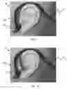 Fig. 02 - Multi-function bone conducting headphones