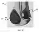 Fig. 03 - Multi-function bone conducting headphones