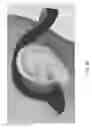 Fig. 41 - Multi-function bone conducting headphones