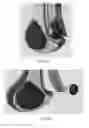 Fig. 44 - Multi-function bone conducting headphones