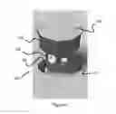Fig. 02 - Irrigation sprinkler with turf cup