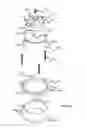 Fig. 08 - Irrigation sprinkler with turf cup