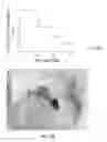 Fig. 09 - Knockout mouse, method for screening substance for suppressing mesial temporal lobe epilepsy, and method for selecting technique for suppressing mesial temporal lobe epilepsy
