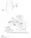Fig. 08 - Hip protector system and method for hip fracture prevention