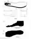 Fig. 02 - INJURY REDUCTION INSOLE
