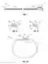 Fig. 04 - Size-adjustable fashion accessory