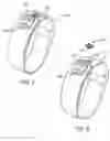 Fig. 04 - INSERTABLE ACCESSORIES FOR PROVIDING ENHANCED PERSONALIZATION OF WRIST-WEARABLE DEVICES