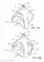 Fig. 41 - Walking stick