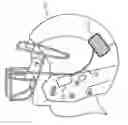 Fig. 01 - Dentally-Based Concussion Sensing System for Enhanced Detection of Brain Injuries