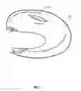 Fig. 02 - Medical device for repairing soft tissue and method of using same