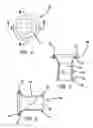 Fig. 04 - Systems and methods for tissue removal