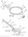 Fig. 33 - Systems and methods for tissue removal
