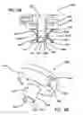 Fig. 45 - Systems and methods for tissue removal