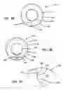 Fig. 49 - Systems and methods for tissue removal